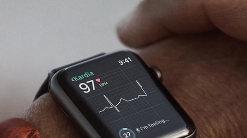 Apple Watch vi phạm bằng sáng chế của AliveCor!